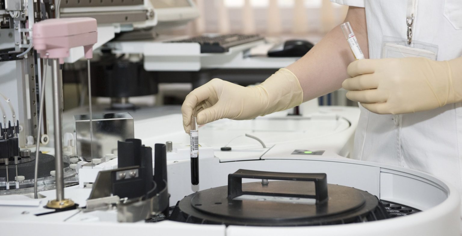 Masitinib in inflammatory diseases – AB Science